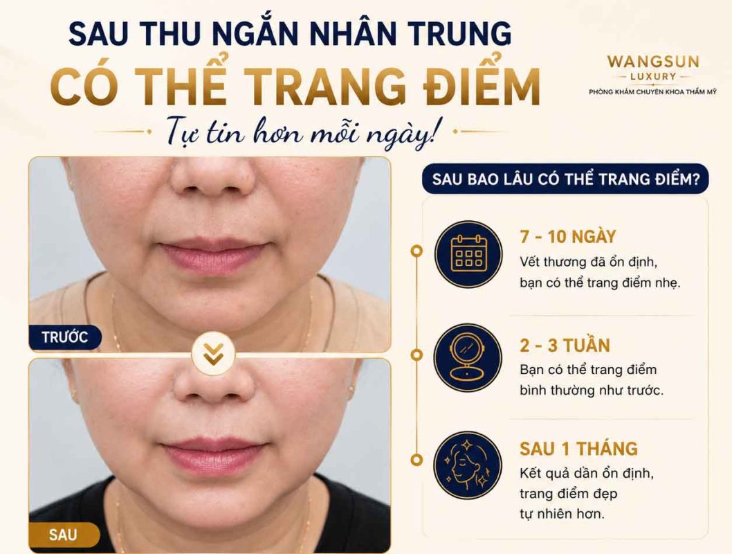 Thu Ngắn Nhân Trung Bao Lâu Thì Hồi Phục? Thời Gian Lành Thương Và Những Điều Cần Biết Sau thu ngắn nhân trung bao lâu thì có thể trang điểm