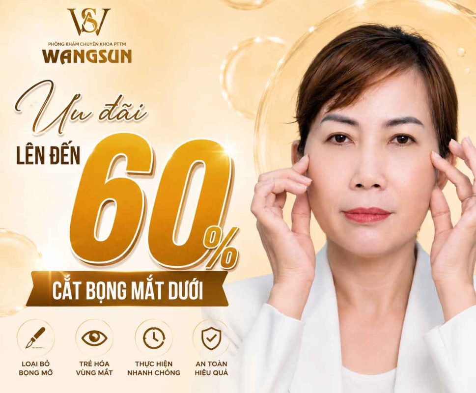 Ưu đãi 60% cắt bọng mắt
