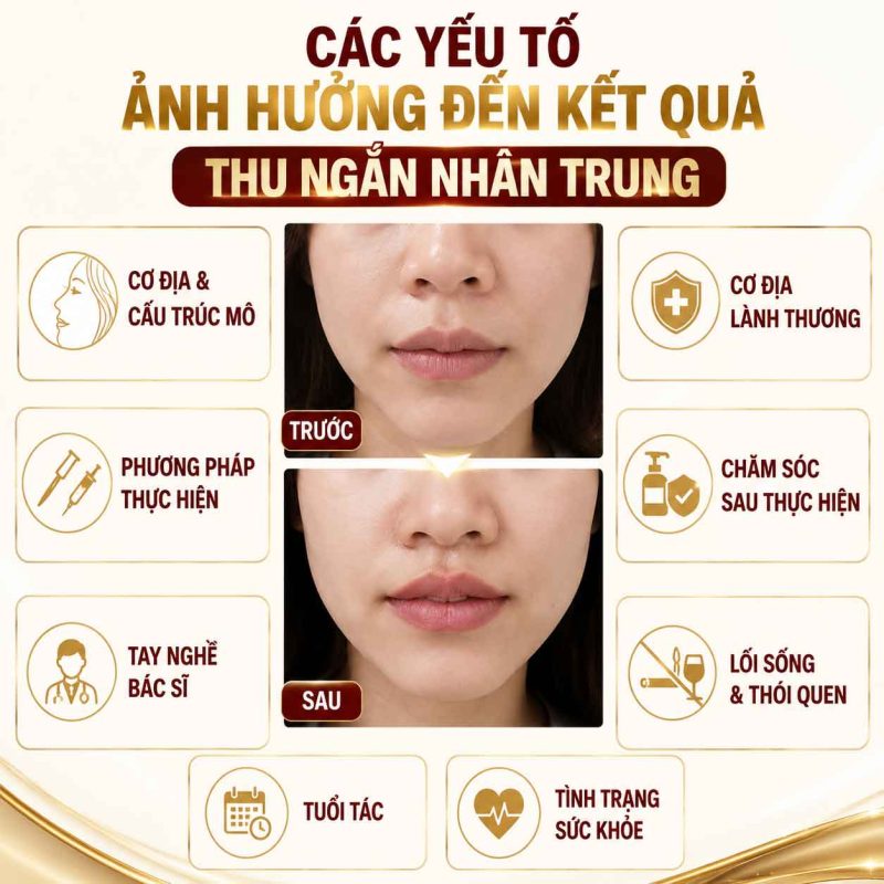 Thu Ngắn Nhân Trung Bao Lâu Thì Hồi Phục? Thời Gian Lành Thương Và Những Điều Cần Biết Yếu tố ảnh hưởng đến thu ngắn nhân trung