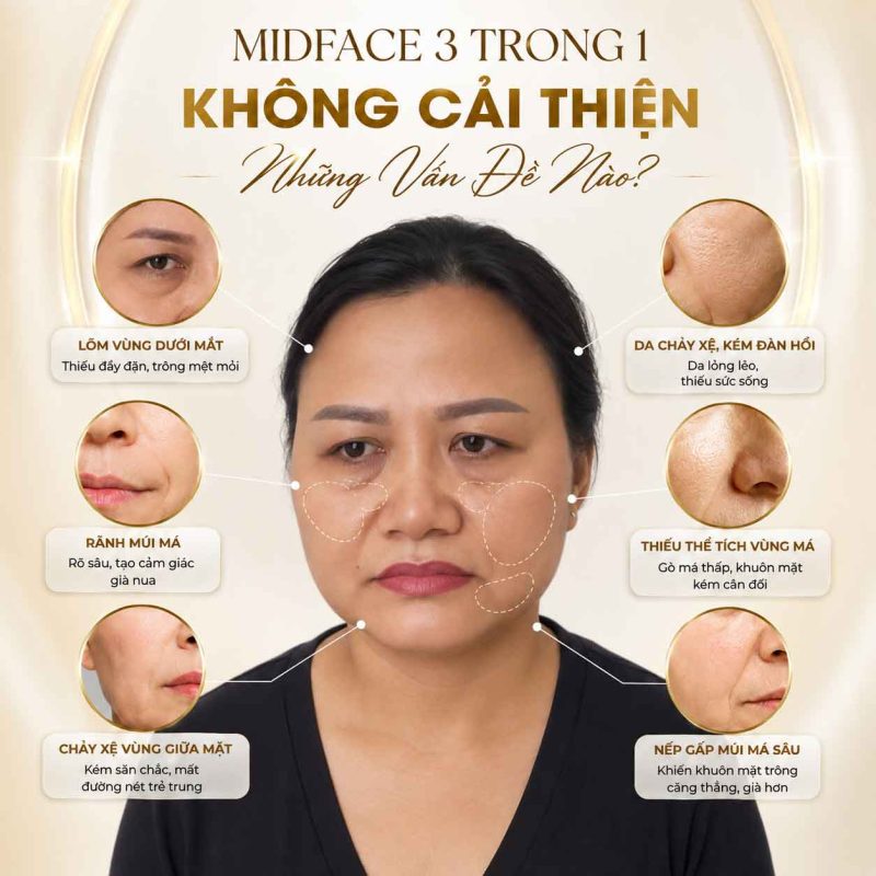 Midface  trong 1 không cải thiện những vùng nào