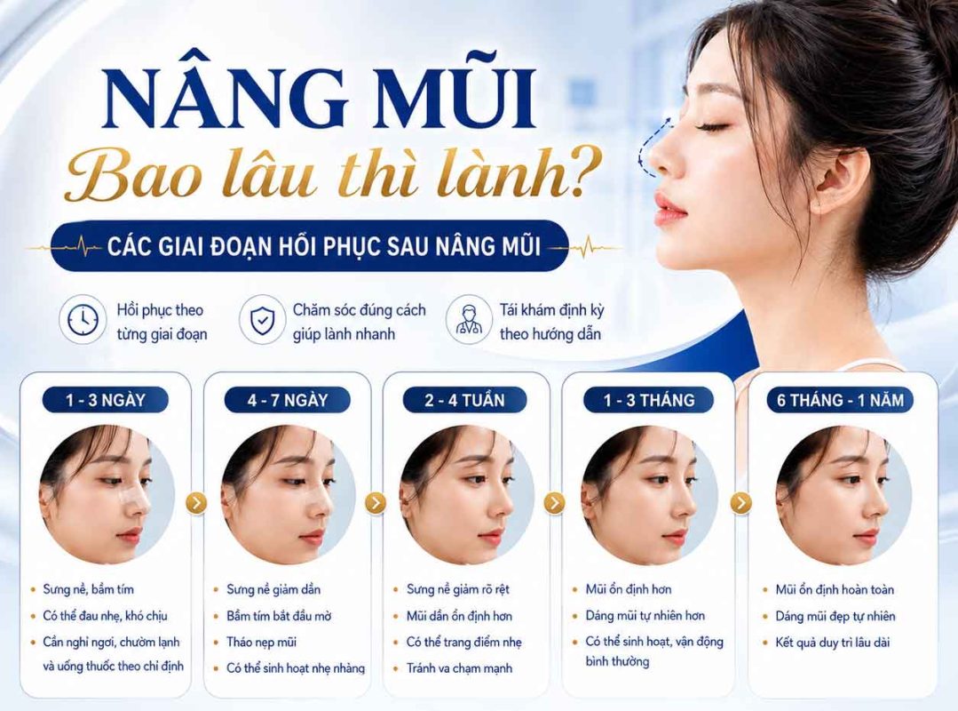 Nâng Mũi Bao Lâu Thì Lành? Các Giai Đoạn Hồi Phục Sau Nâng Mũi