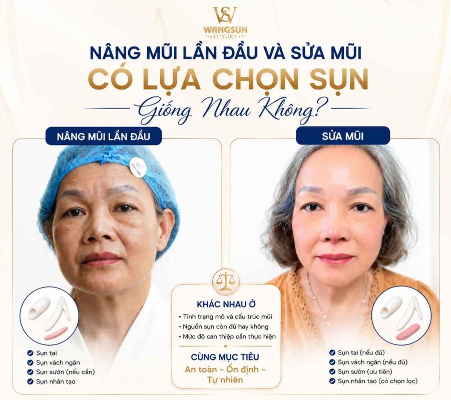 Sụn tự thân trong nâng mũi gồm những loại nào? Nâng Mũi Lần Đầu Và Sửa Mũi Có Lựa Chọn Sụn Giống Nhau Không?