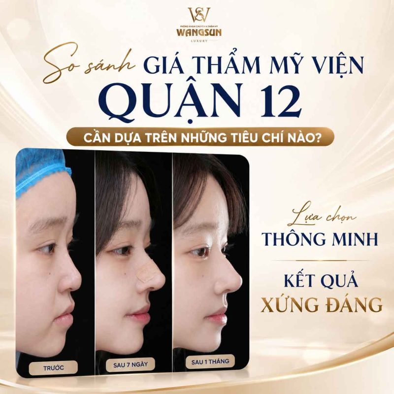 So sánh giá thẩm mỹ viện Quận 12 cần dựa trên những tiêu chí nào?