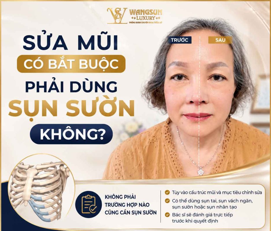 Nâng mũi lần đầu và sửa mũi có lựa chọn sụn giống nhau không? Sửa mũi có bắt buộc phải dùng sụn sườn không