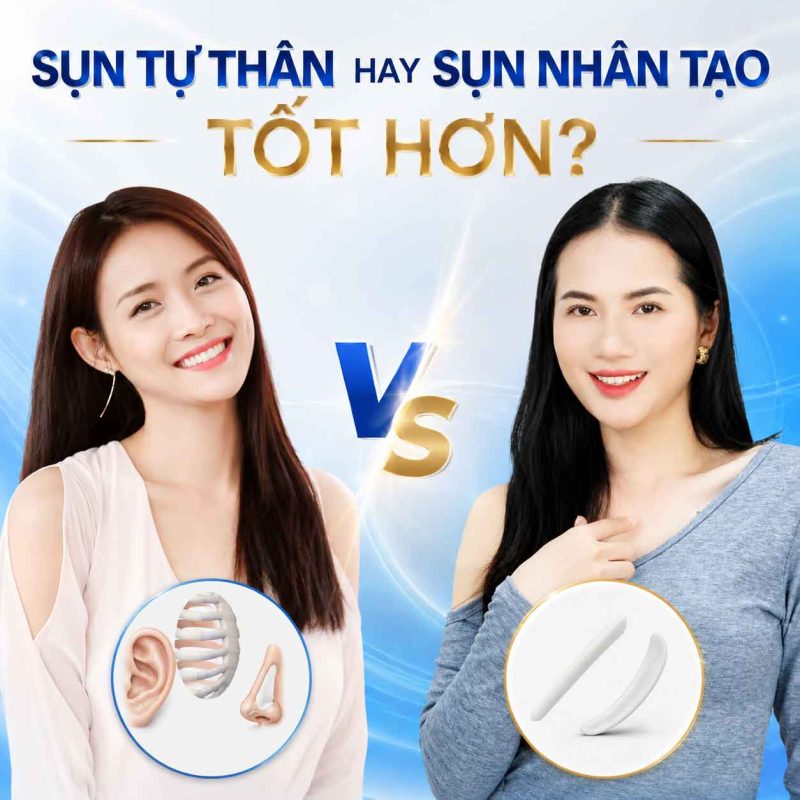 Nâng mũi sụn tự thân có tốt không? Sụn tự thân hay sụn nhân tạo tốt hơn