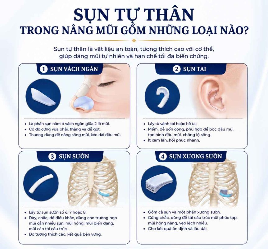 Sụn tự thân trong nâng mũi gồm những loại nào? Sụn tự thân trong nâng mũi gồm những loại nào