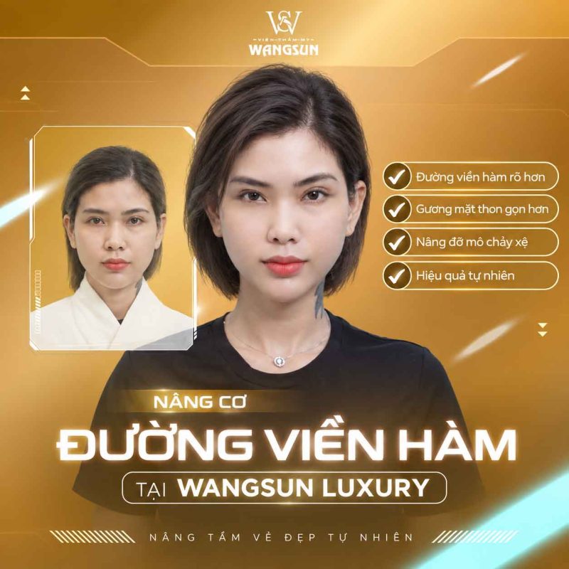 Nâng cơ có giúp đường viền hàm gọn hơn không Nâng cơ đường viền hàm Wangsun Luxury