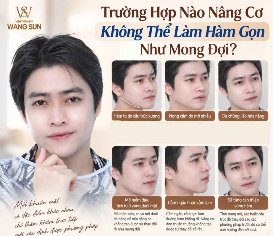 Nâng cơ có giúp đường viền hàm gọn hơn không Trường hợp nào nâng cơ không thể làm thon gọn hàm